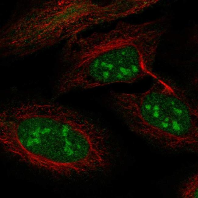 LRWD1 Antibody in Immunocytochemistry (ICC/IF)