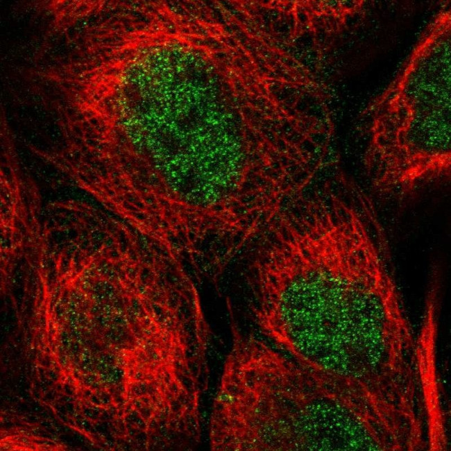 WIPI2 Antibody in Immunocytochemistry (ICC/IF)