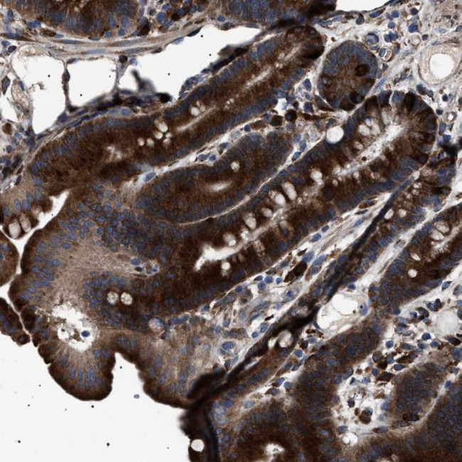 TOP1MT Antibody in Immunohistochemistry (Paraffin) (IHC (P))