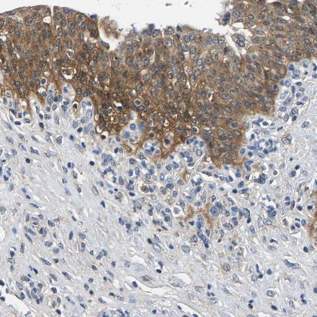 NT5C Antibody in Immunohistochemistry (IHC)