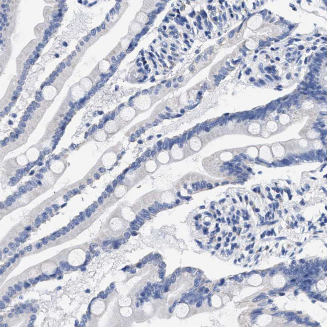 KLHL41 Antibody in Immunohistochemistry (Paraffin) (IHC (P))