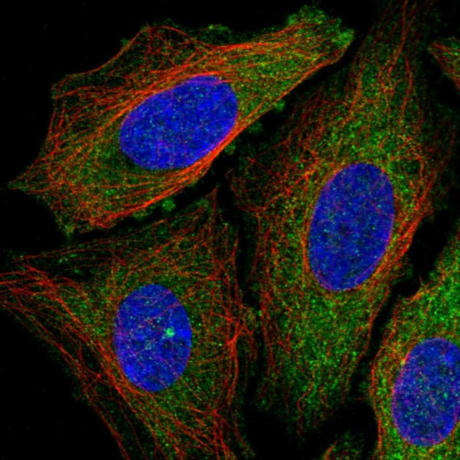 DENR Antibody in Immunocytochemistry (ICC/IF)