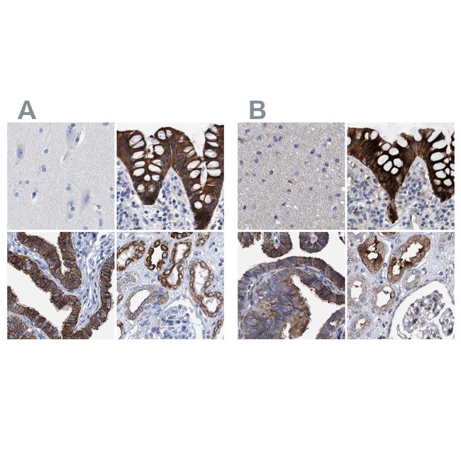 MKS1 Antibody in Immunohistochemistry (IHC)