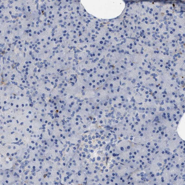 HS3ST5 Antibody in Immunohistochemistry (Paraffin) (IHC (P))