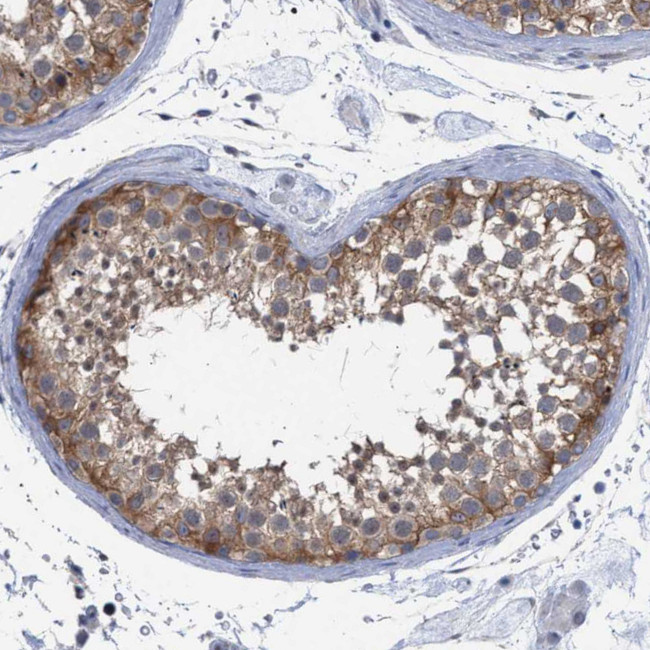 FHOD3 Antibody in Immunohistochemistry (Paraffin) (IHC (P))