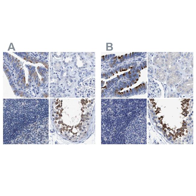 DNAI1 Antibody in Immunohistochemistry (IHC)