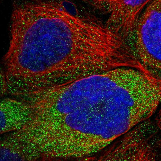 LRSAM1 Antibody in Immunocytochemistry (ICC/IF)