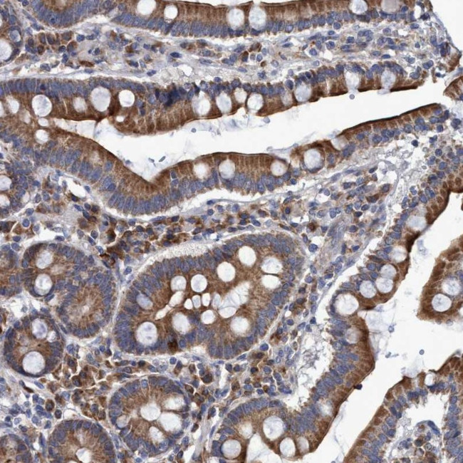 NAT16 Antibody in Immunohistochemistry (Paraffin) (IHC (P))