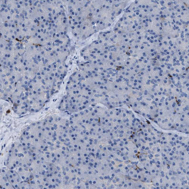 SLC47A1 Antibody in Immunohistochemistry (Paraffin) (IHC (P))