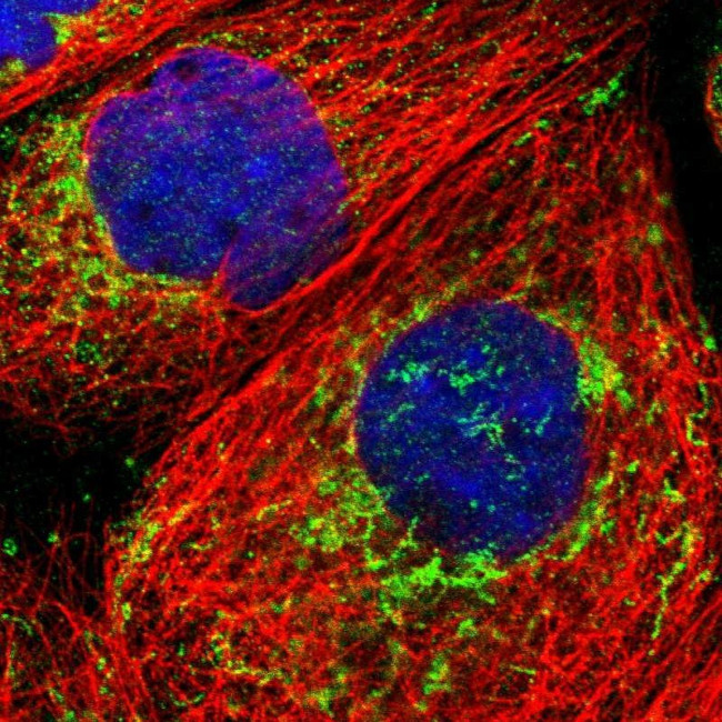 ECHS1 Antibody in Immunocytochemistry (ICC/IF)