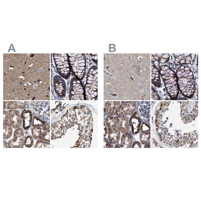 MECR Antibody in Immunohistochemistry (IHC)