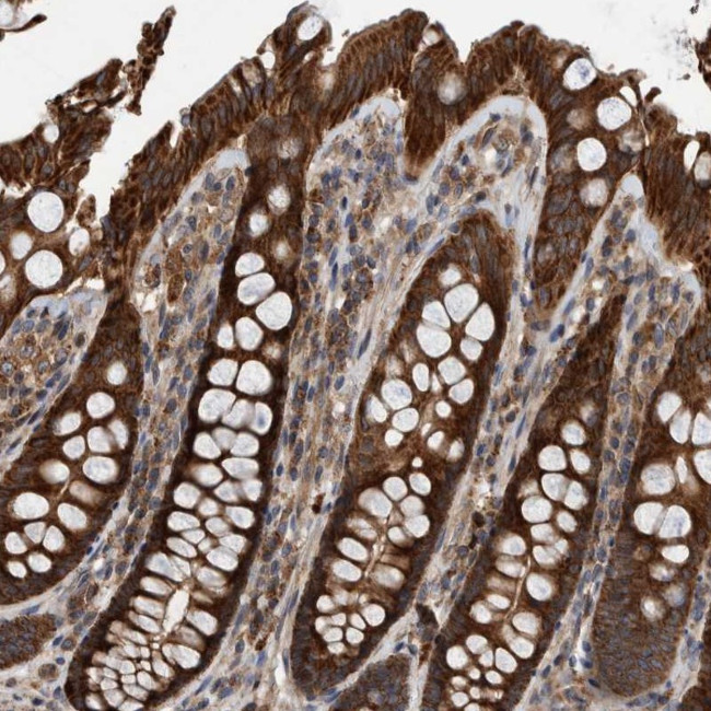 ABCA5 Antibody in Immunohistochemistry (Paraffin) (IHC (P))