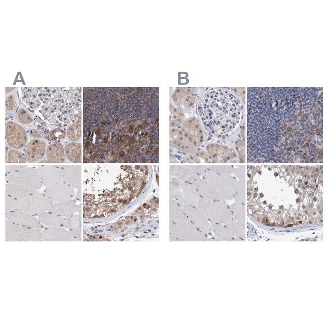 PFAS Antibody in Immunohistochemistry (IHC)