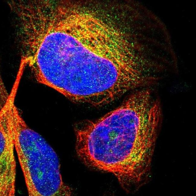 CDK5RAP3 Antibody in Immunocytochemistry (ICC/IF)