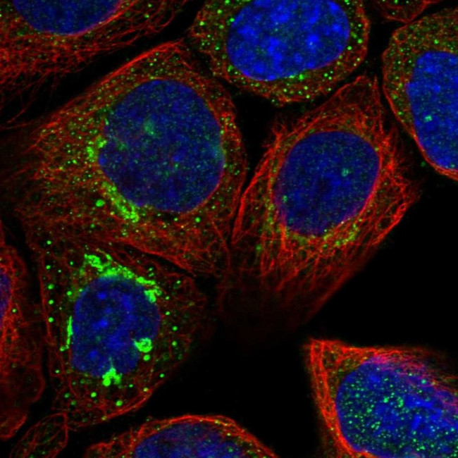 ATP6V0A1 Antibody in Immunocytochemistry (ICC/IF)