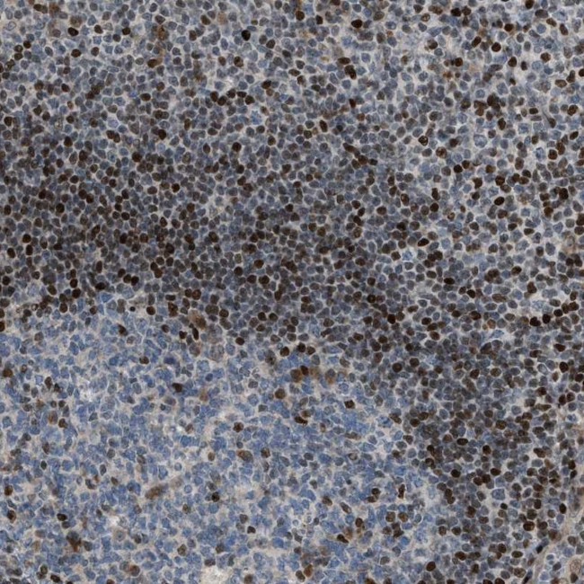 ZNF276 Antibody in Immunohistochemistry (Paraffin) (IHC (P))