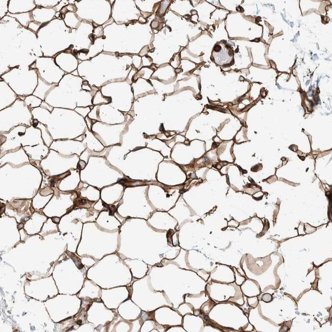 PKD1L1 Antibody in Immunohistochemistry (IHC)