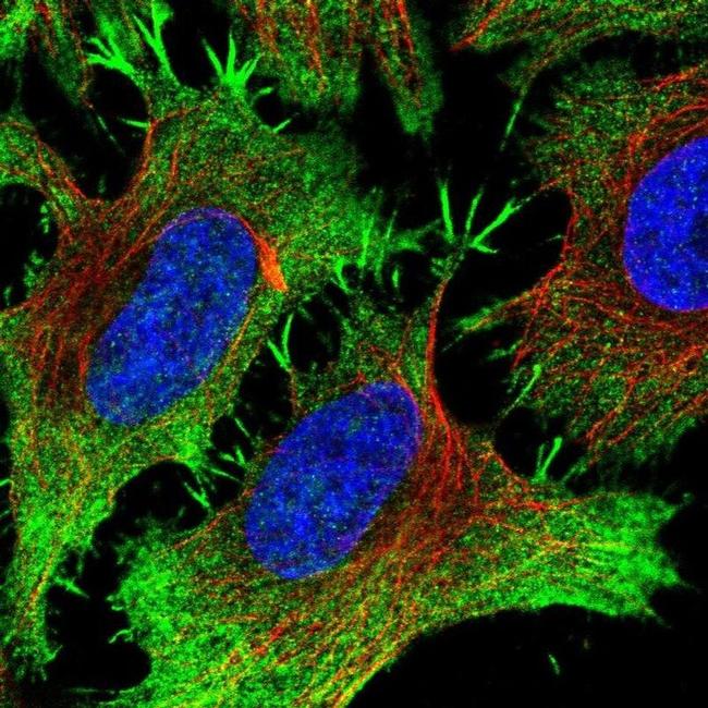 PITPNM3 Antibody in Immunocytochemistry (ICC/IF)