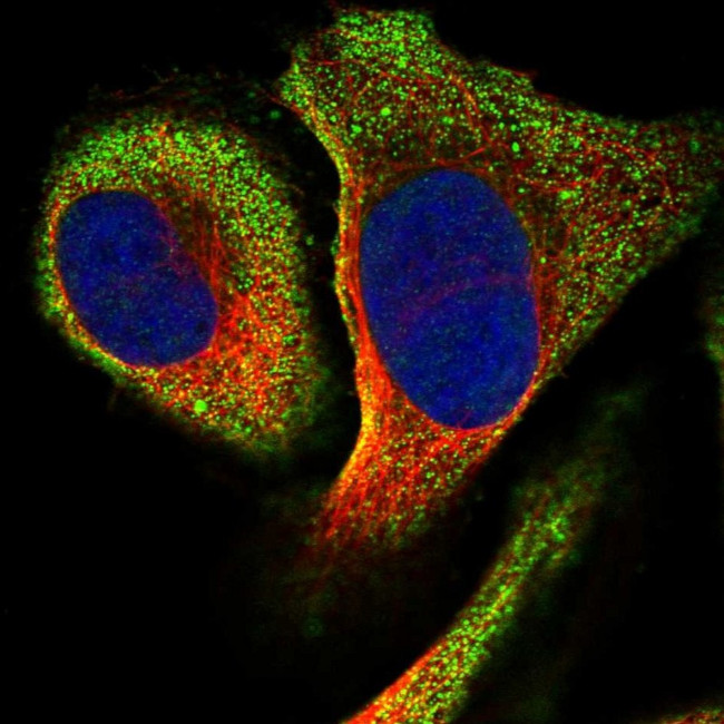 RSAD1 Antibody in Immunocytochemistry (ICC/IF)