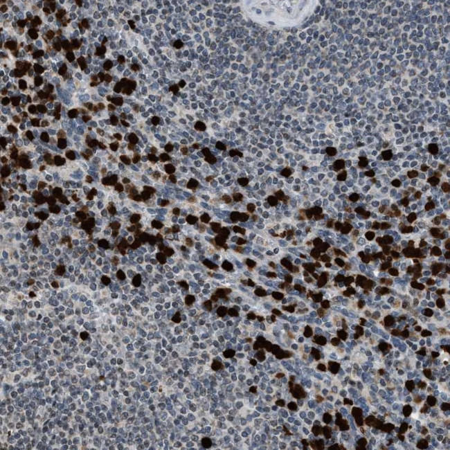 PRUNE2 Antibody in Immunohistochemistry (Paraffin) (IHC (P))