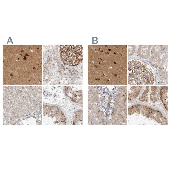 TOM1L2 Antibody in Immunohistochemistry (IHC)