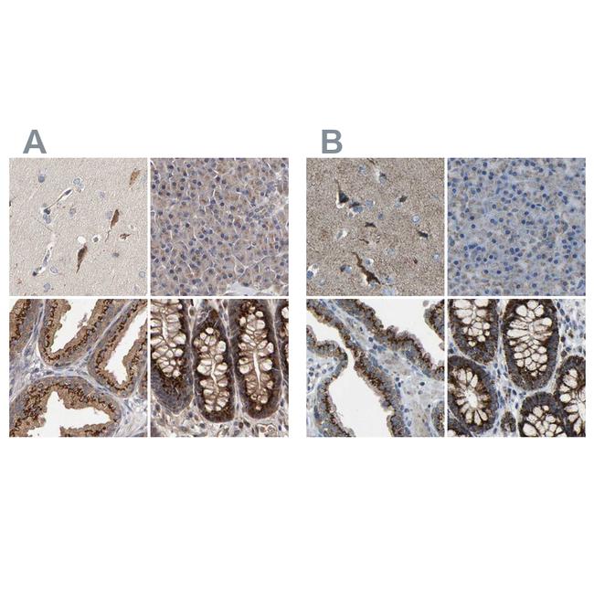 CANT1 Antibody in Immunohistochemistry (IHC)