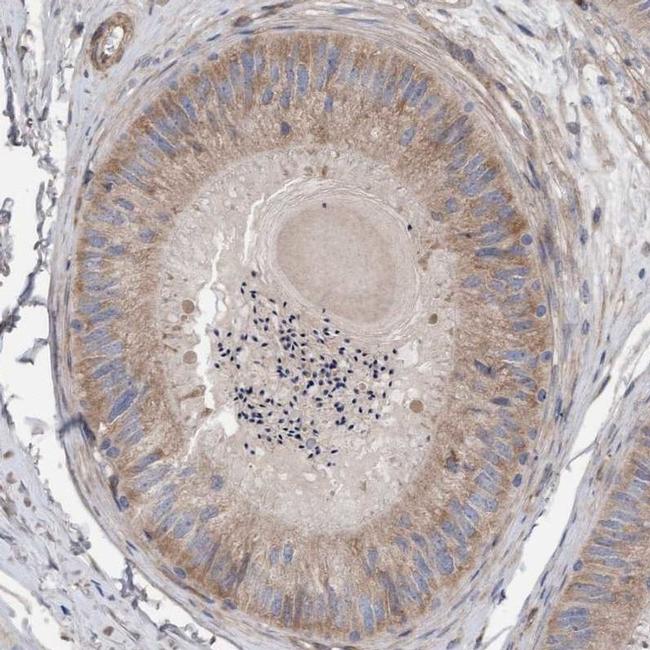 CDK5RAP3 Antibody in Immunohistochemistry (IHC)