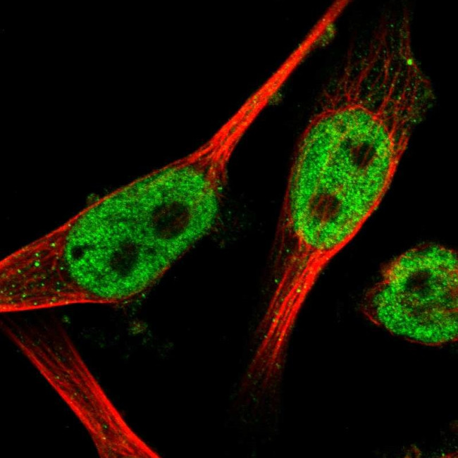 WIZ Antibody in Immunocytochemistry (ICC/IF)