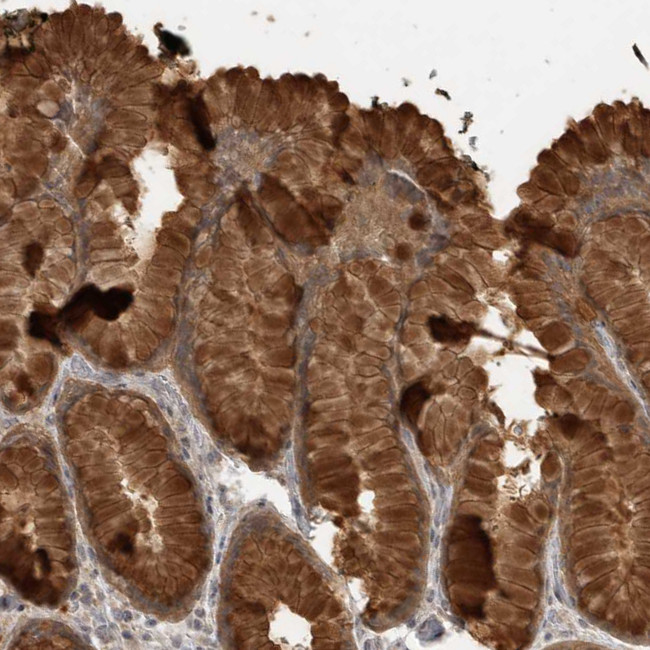 LLGL1 Antibody in Immunohistochemistry (Paraffin) (IHC (P))