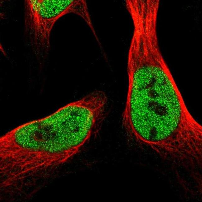 SCRN2 Antibody in Immunocytochemistry (ICC/IF)