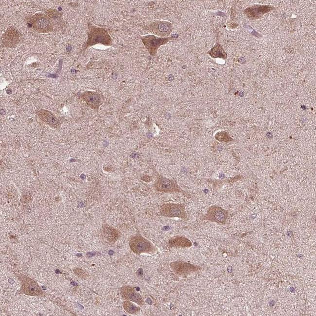 RIPX Antibody in Immunohistochemistry (IHC)