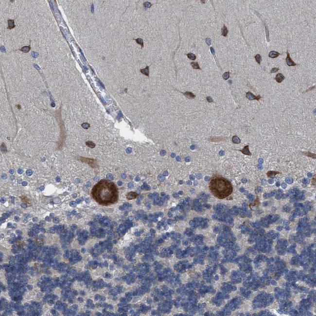 NMT1 Antibody in Immunohistochemistry (IHC)