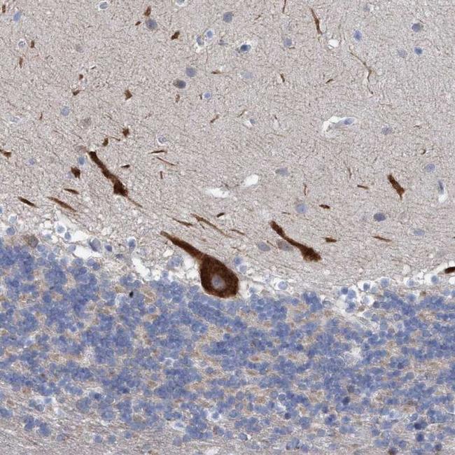 RSAD1 Antibody in Immunohistochemistry (IHC)