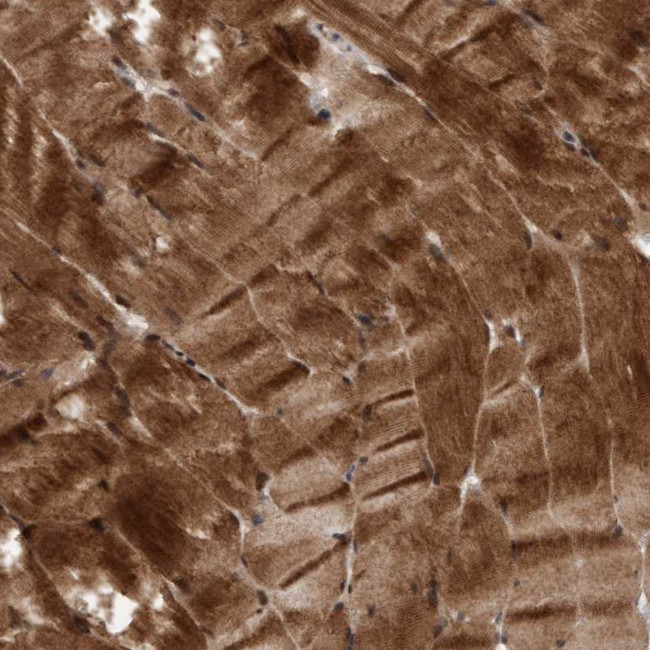 MLXIP Antibody in Immunohistochemistry (Paraffin) (IHC (P))