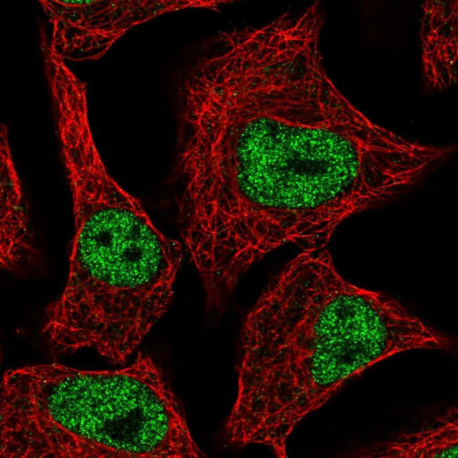 ZNF574 Antibody in Immunocytochemistry (ICC/IF)