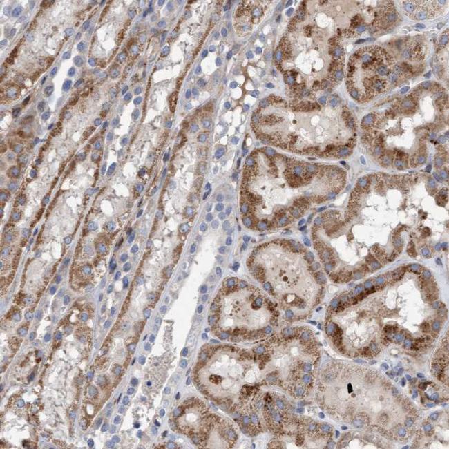 POLG2 Antibody in Immunohistochemistry (IHC)