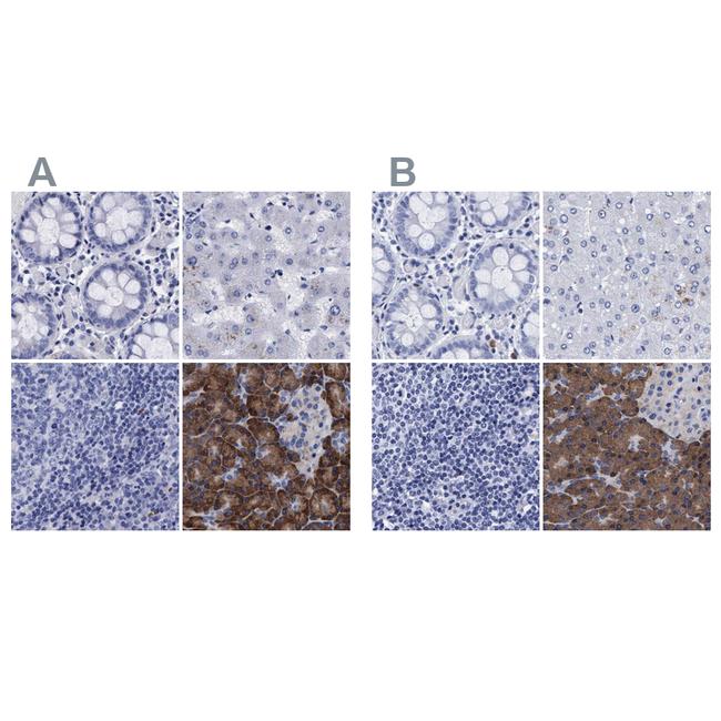 Arylsulfatase G Antibody in Immunohistochemistry (IHC)