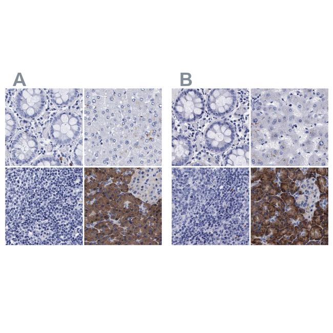 Arylsulfatase G Antibody in Immunohistochemistry (IHC)