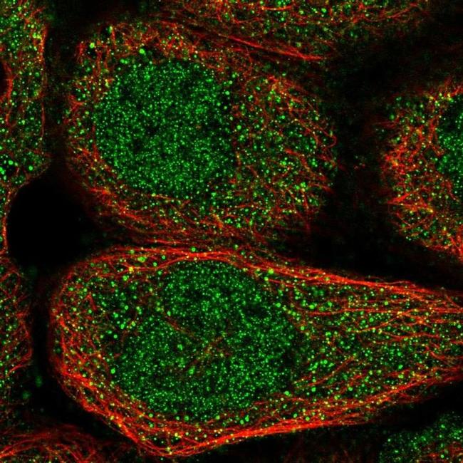 NPLOC4 Antibody in Immunocytochemistry (ICC/IF)