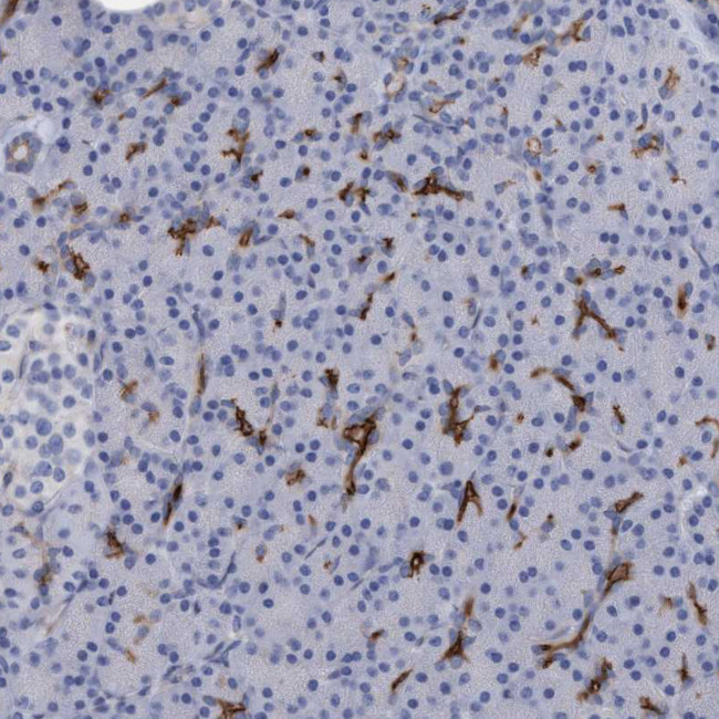 SLC28A3 Antibody in Immunohistochemistry (Paraffin) (IHC (P))