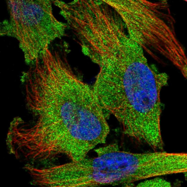 TSTA3 Antibody in Immunocytochemistry (ICC/IF)