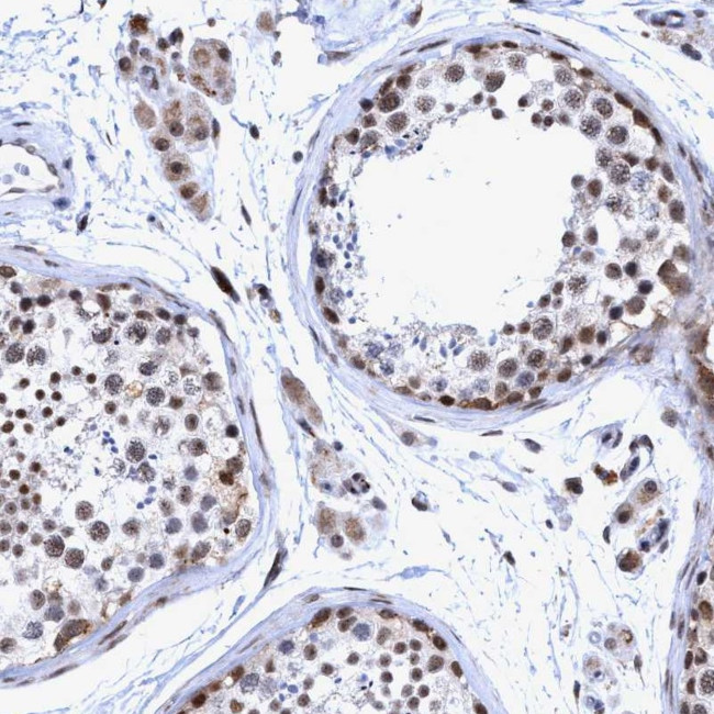 GLT6D1 Antibody in Immunohistochemistry (Paraffin) (IHC (P))