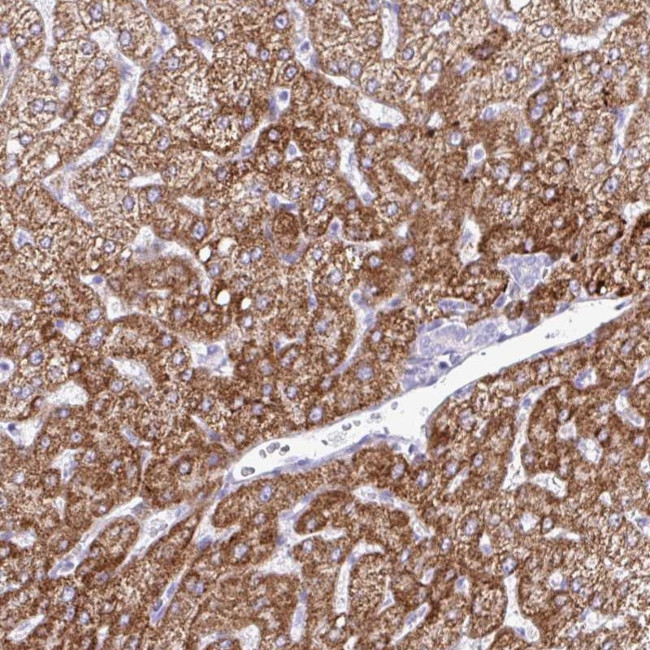 ZNF101 Antibody in Immunohistochemistry (Paraffin) (IHC (P))