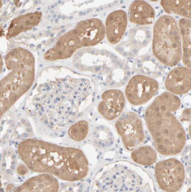 HRSP12 Antibody in Immunohistochemistry (Paraffin) (IHC (P))