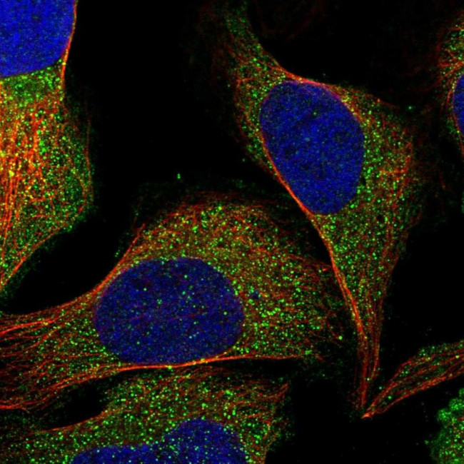 RUNDC3A Antibody in Immunocytochemistry (ICC/IF)