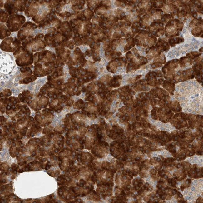 CtBP2 Antibody in Immunohistochemistry (Paraffin) (IHC (P))