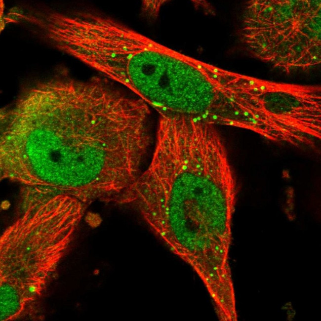 TRIM8 Antibody in Immunocytochemistry (ICC/IF)