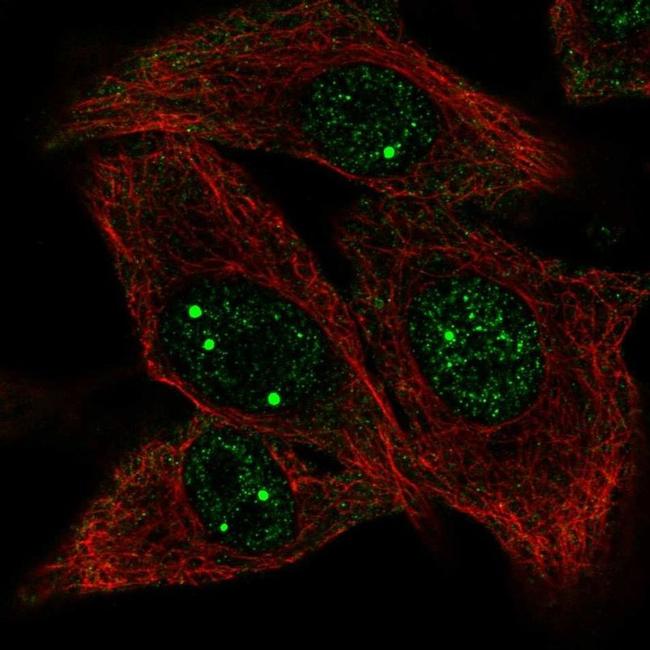 UBE2O Antibody in Immunocytochemistry (ICC/IF)