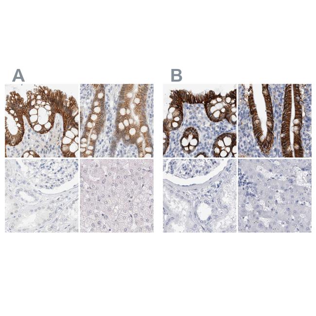 CDH17 Antibody in Immunohistochemistry (IHC)