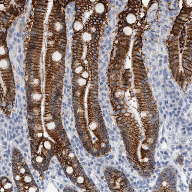 CDH17 Antibody in Immunohistochemistry (Paraffin) (IHC (P))